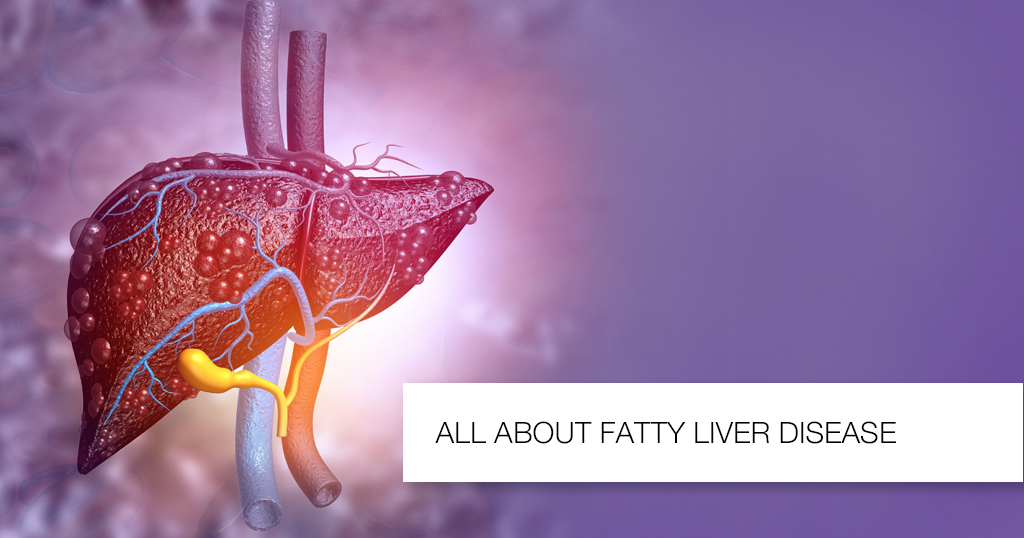 ALL ABOUT FATTY LIVER DISEASE