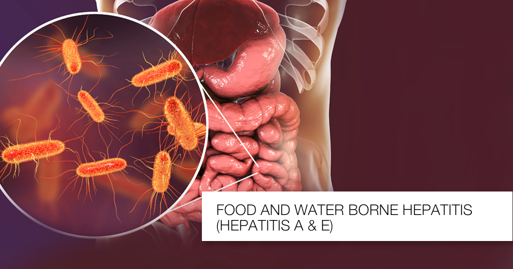 Food and Water Borne Hepatitis (Hepatitis A & E)