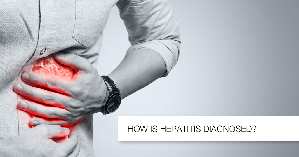 How is Hepatitis Diagnosed?