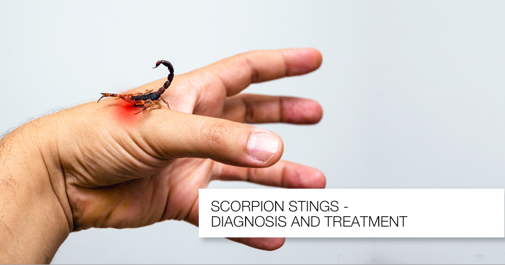 Scorpion Stings – Diagnosis and Treatment