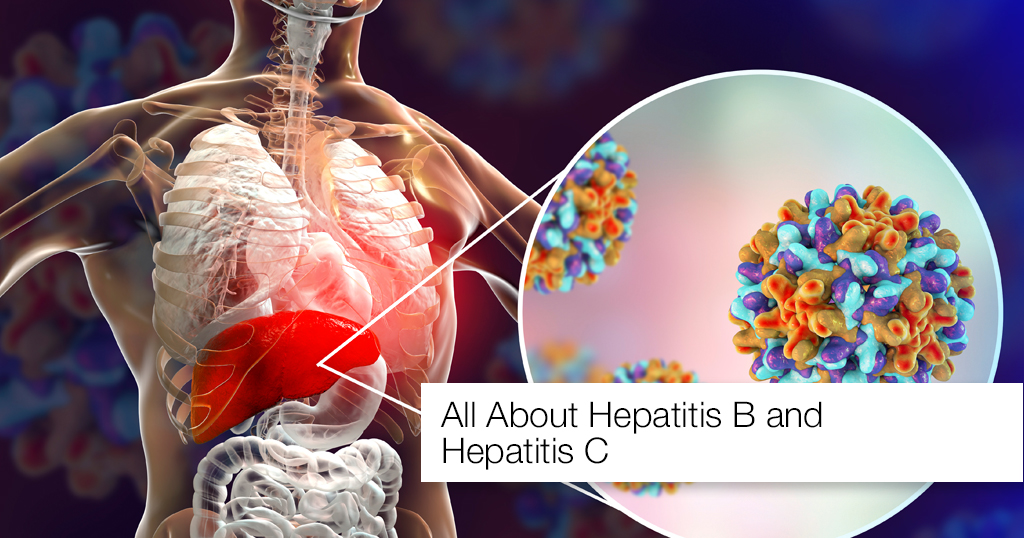 All About Hepatitis B and Hepatitis C