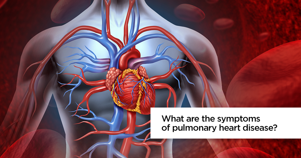 What are the symptoms of pulmonary heart disease?