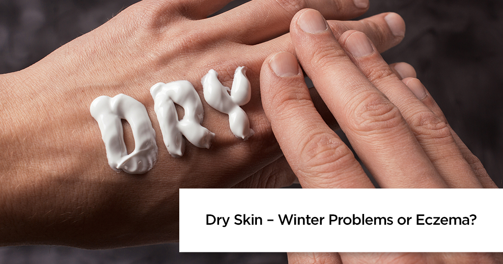 Dry Skin – Winter Problems or Eczema?