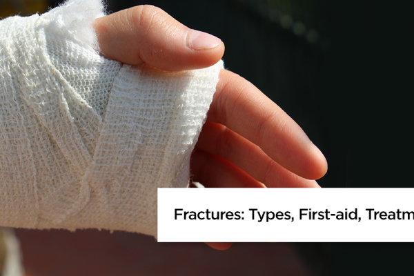 Types of Fractures & First Aid Treatment