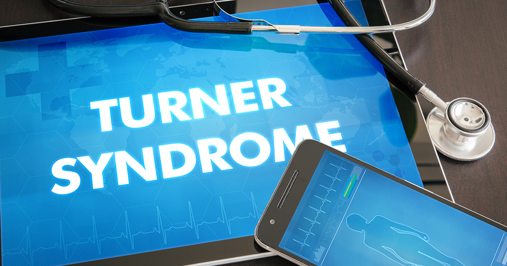 All About Turner Syndrome