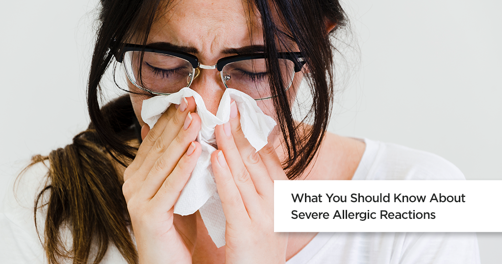 What you Should Know About Severe Allergic Reactions