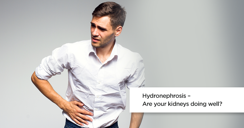 Hydronephrosis : Symptoms, Causes & Treatment