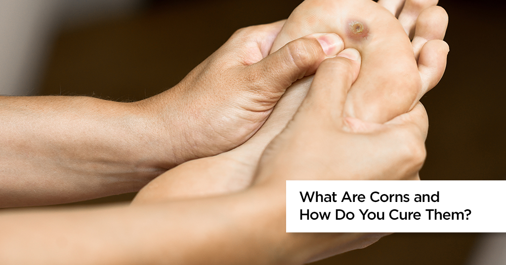 What are Foot Corns Symptoms Causes Treatments Precautions