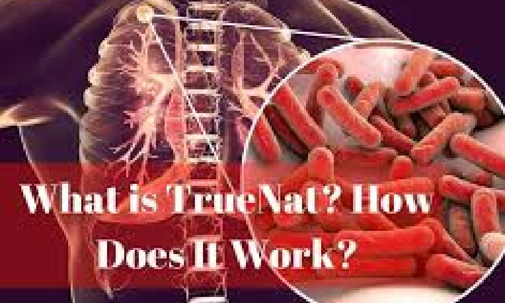 What is TrueNat Test and How Does It Work?