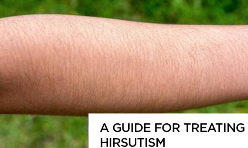 Hirsutism – Causes, Symptoms and Treatment