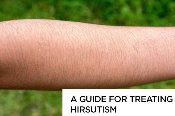 Hirsutism – Causes, Symptoms and Treatment