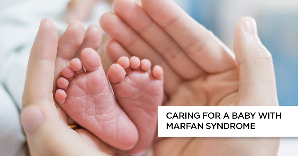 Caring for a Baby With Marfan Syndrome