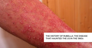 The History of Rubella: The Disease that Haunted the US in the 1960s