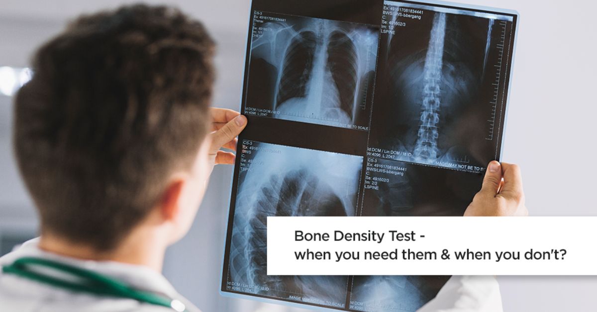 Bone Density Test – When You Need Them & When You Don’t