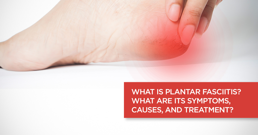 What is Plantar Fasciitis? What are its Symptoms, Causes, and Treatment?