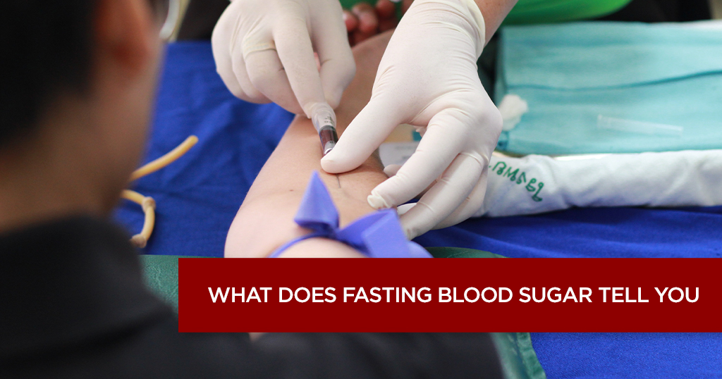 What Does Fasting Blood Sugar Test Tell You?