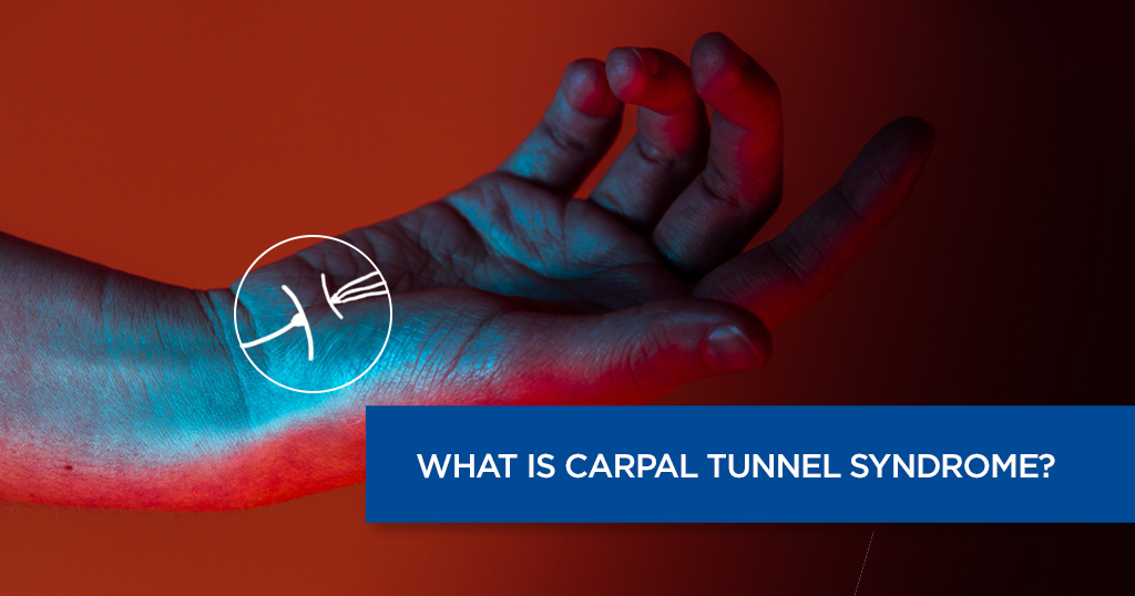 What is Carpal Tunnel Syndrome?