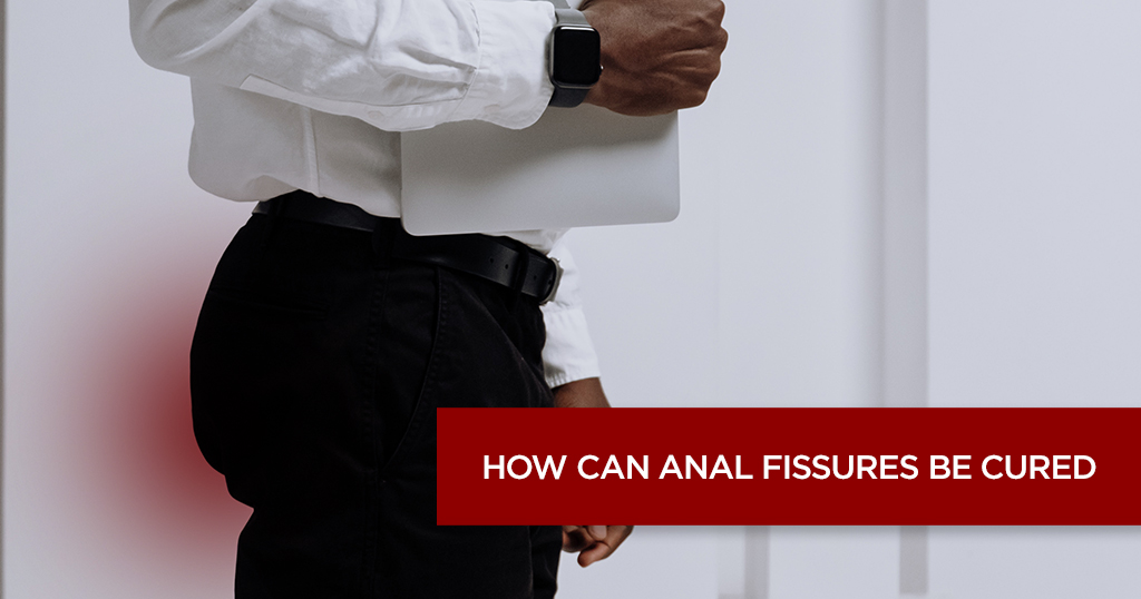 Anal Fissures – Causes, Symptoms and Treatment