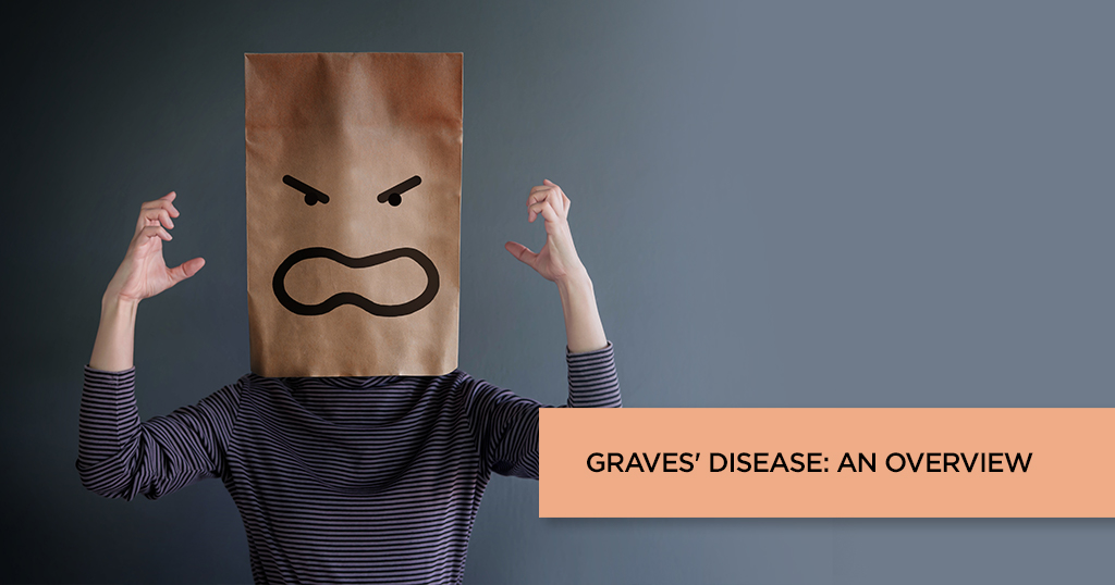 Graves’ Disease: An Overview