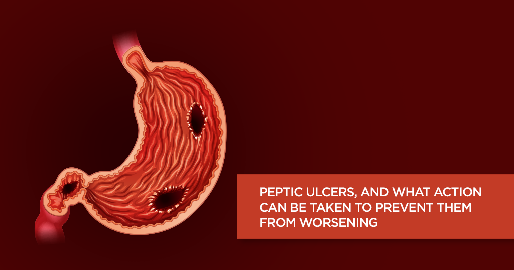 Peptic Ulcers, and What Action Can Be Taken To Prevent Them from Worsening