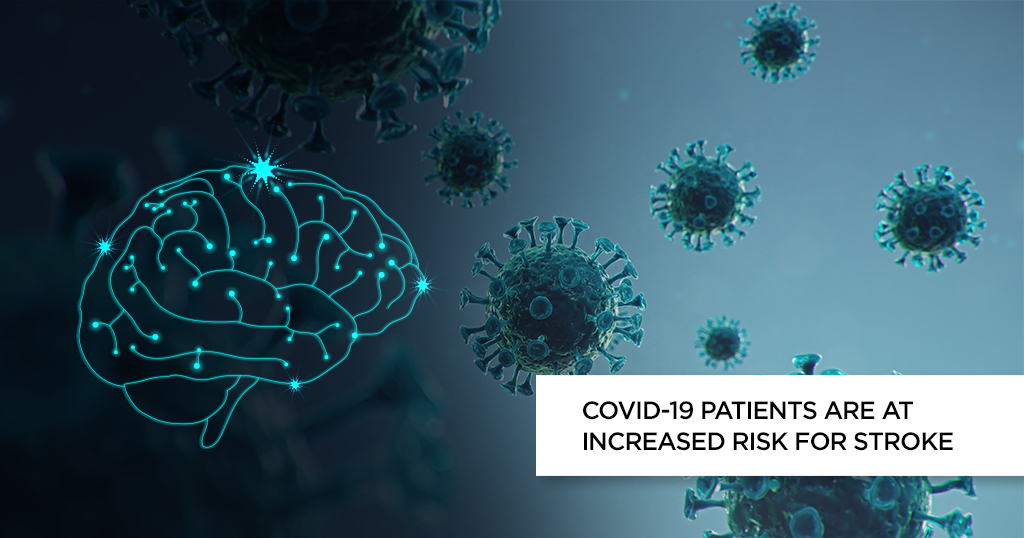 COVID-19 Patients are at Increased Risk For Stroke