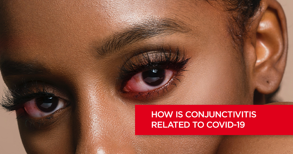 How is Conjunctivitis Related to COVID-19?