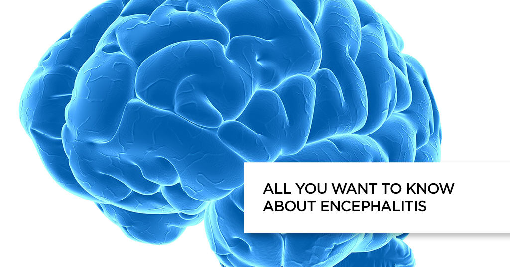 All You Want to Know About Encephalitis