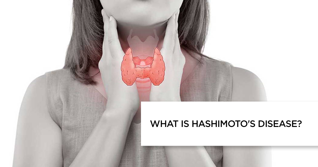 What is Hashimoto’s disease?