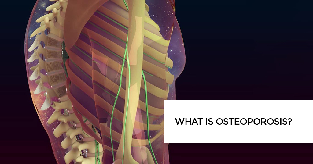 What is Osteoporosis?