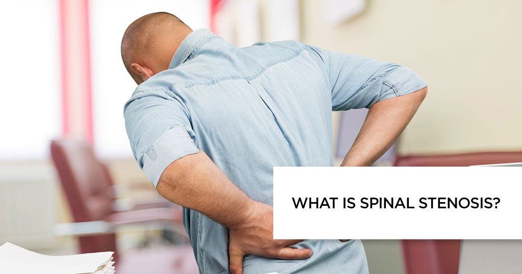 What is Spinal Stenosis?