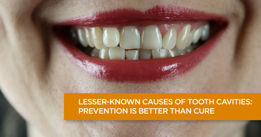 Lesser-Known Causes of Tooth Cavities: Prevention is Better Than Cure