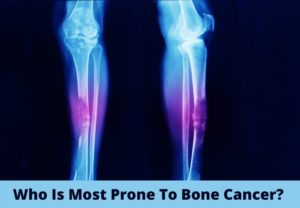 Who Is Most Prone To Bone Cancer?