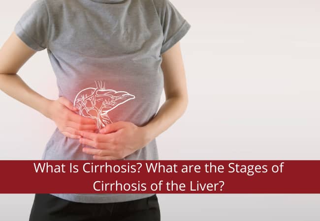 What Is Cirrhosis? What are the Stages of Cirrhosis of the Liver?