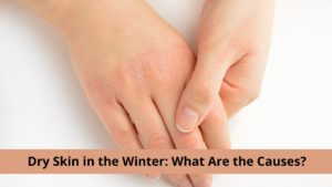 Dry Skin in the Winter: What Are the Causes?