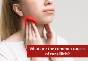 What are the common causes of tonsillitis?