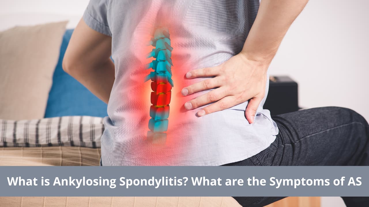 Ankylosing Spondylitis – Types, Symptoms, Causes and Treatment