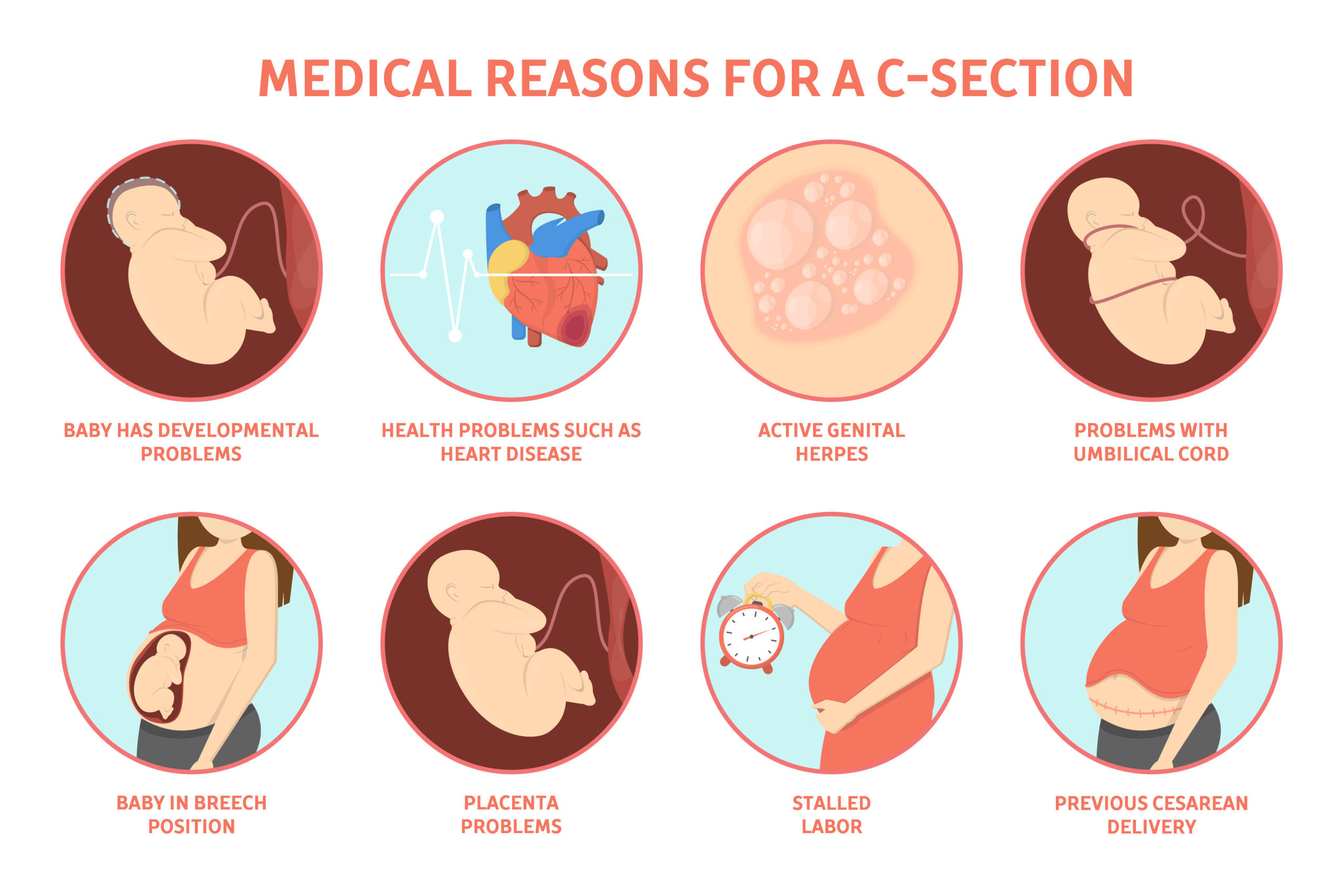 What are the Indications of C SECTION?