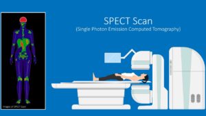 What is a SPECT Scan Commonly Used For?