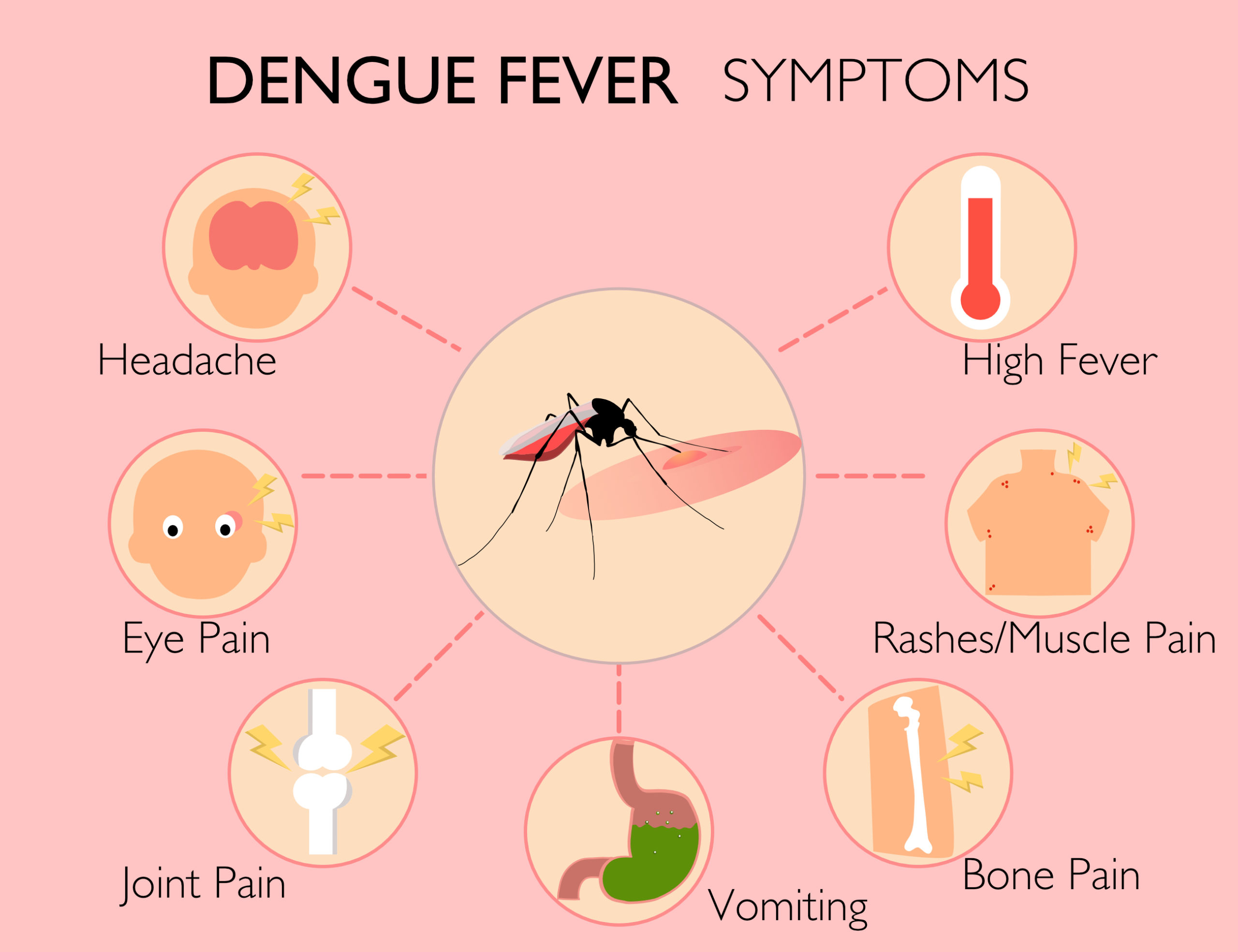 What causes dengue and its common symptoms?