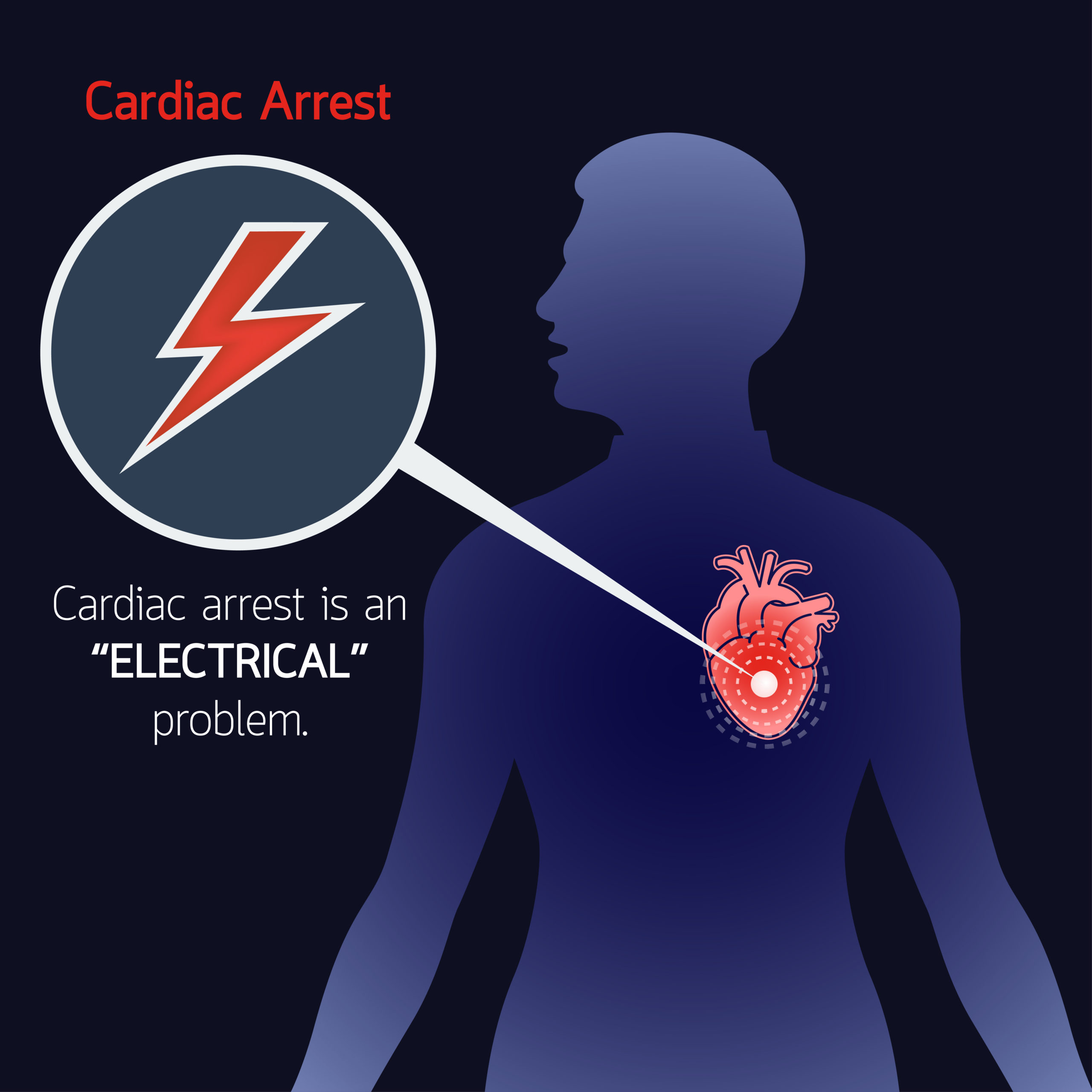 All You Should Know About Cardiac Arrest