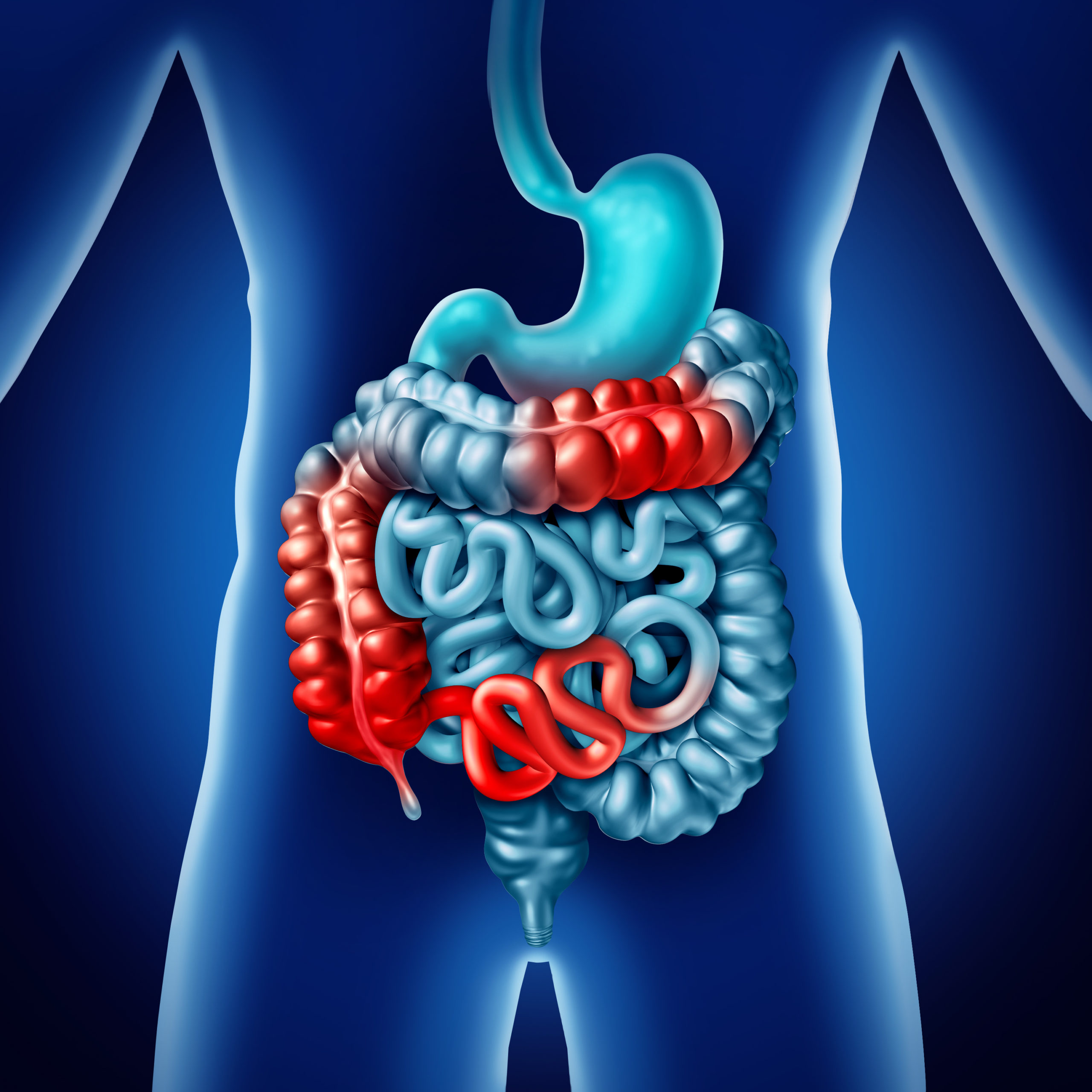 Intestinal Obstruction – Factors, Types and Treatment