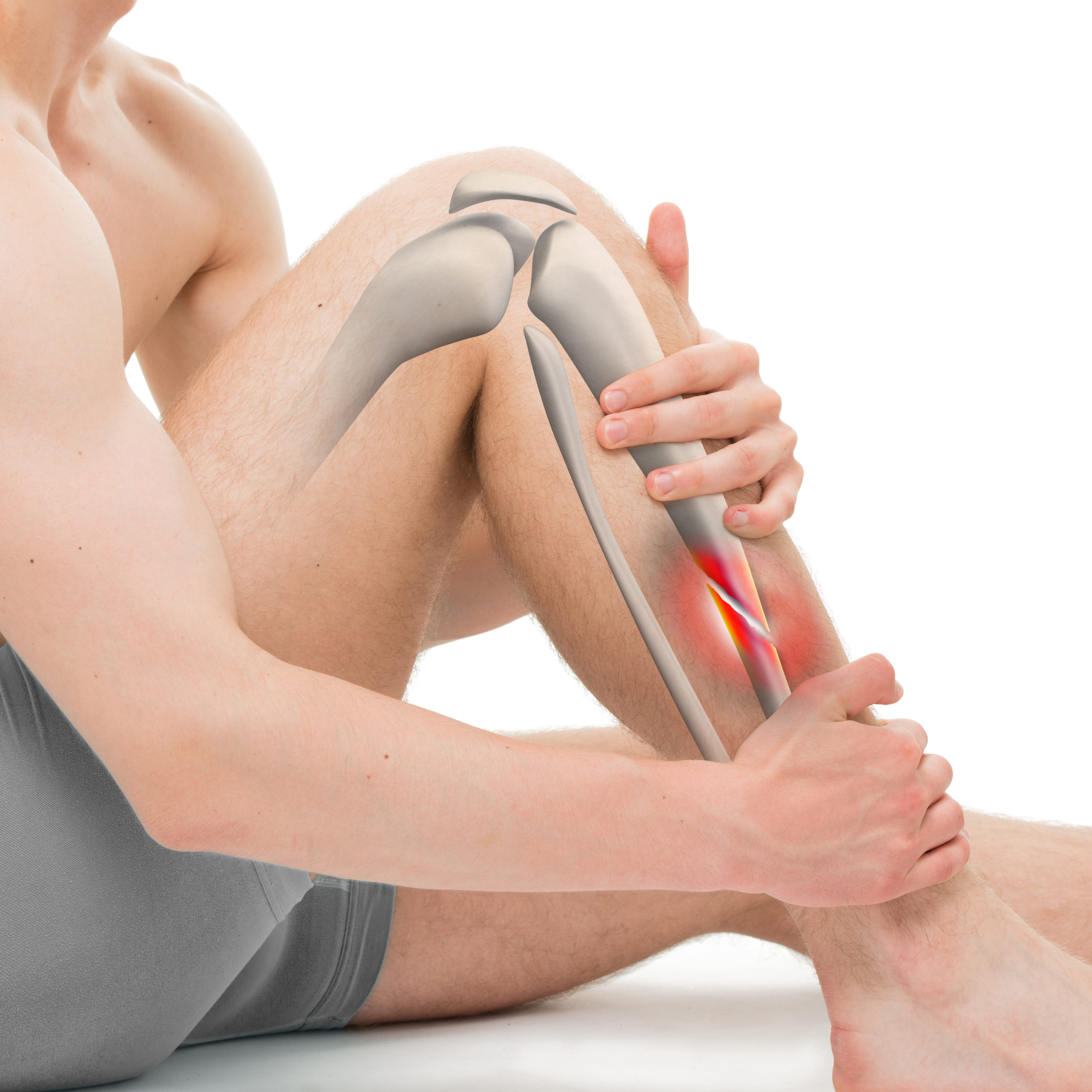 Pain At Pressure Points? You May Have A Stress Fracture