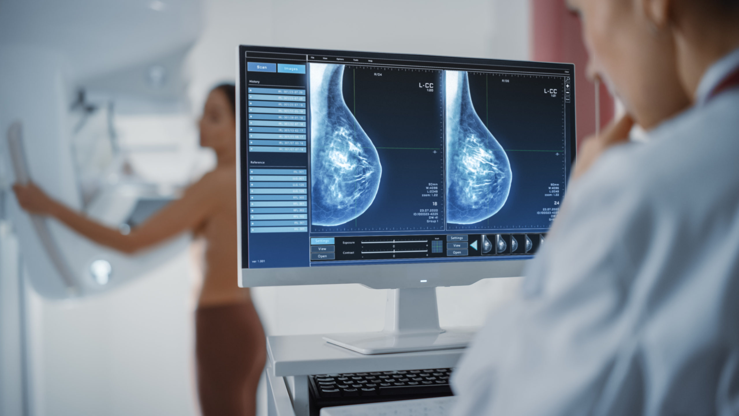 3D Mammogram or Tomosynthesis – Everything You Need to Know