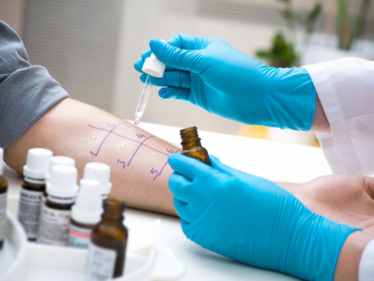 Allergy Skin Tests – An Overview