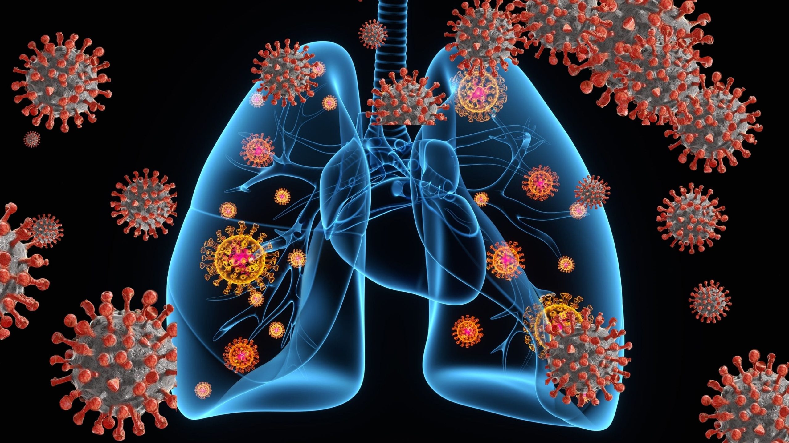 Silent Hypoxia or Happy Hypoxia in COVID-19 Patients