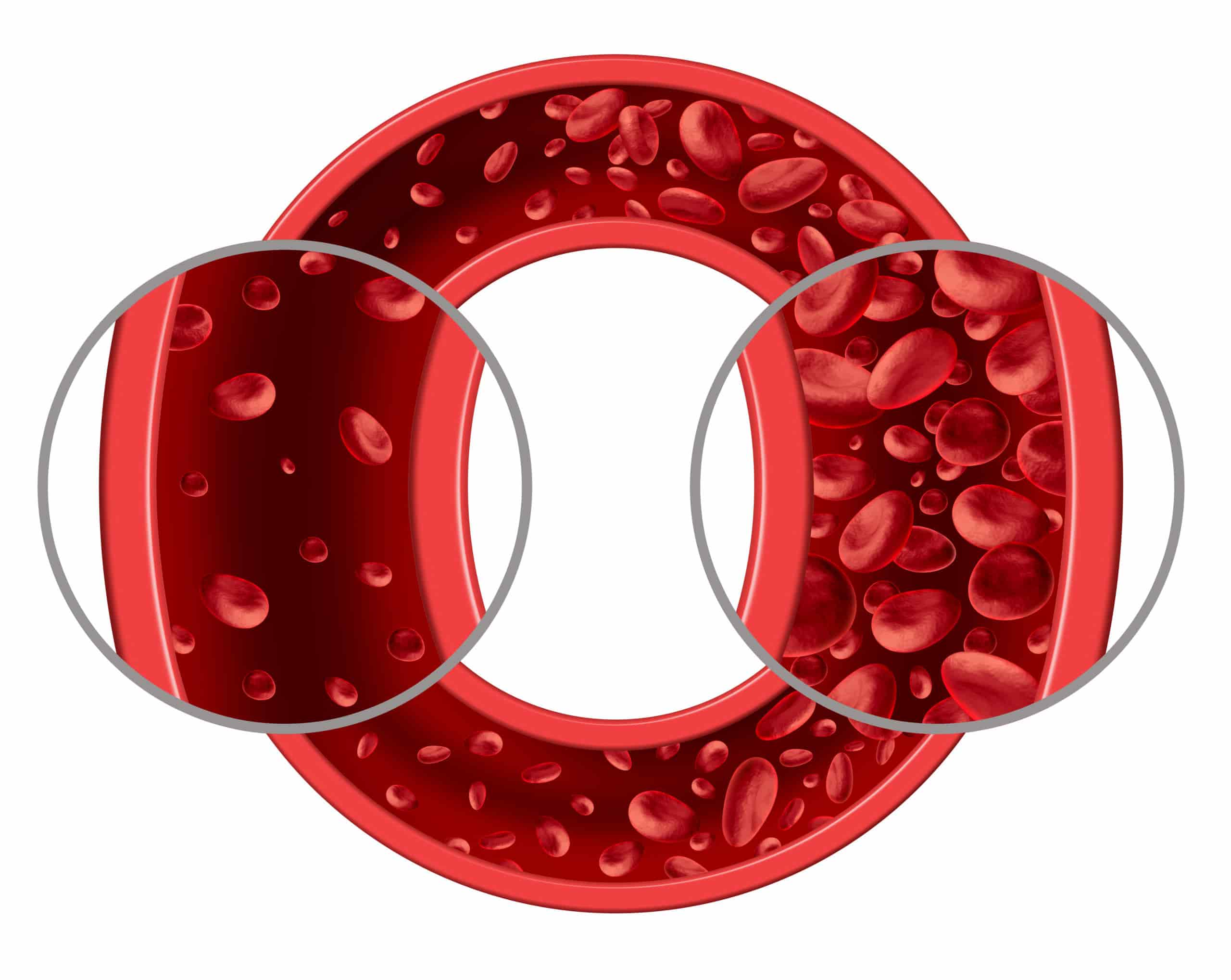 High Hemoglobin Count