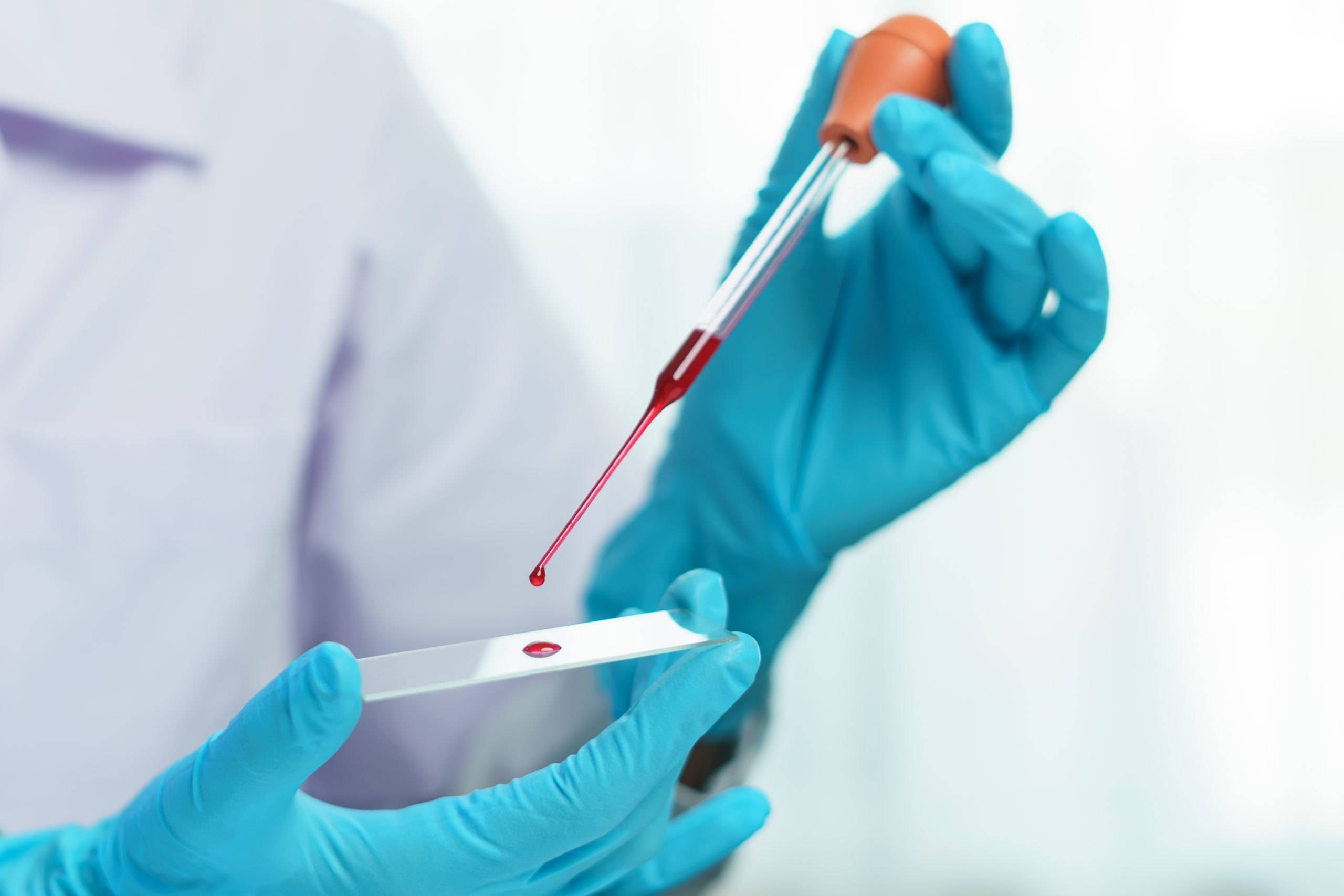 What is the Significance and Importance of Performing a Complete Blood Count Test?