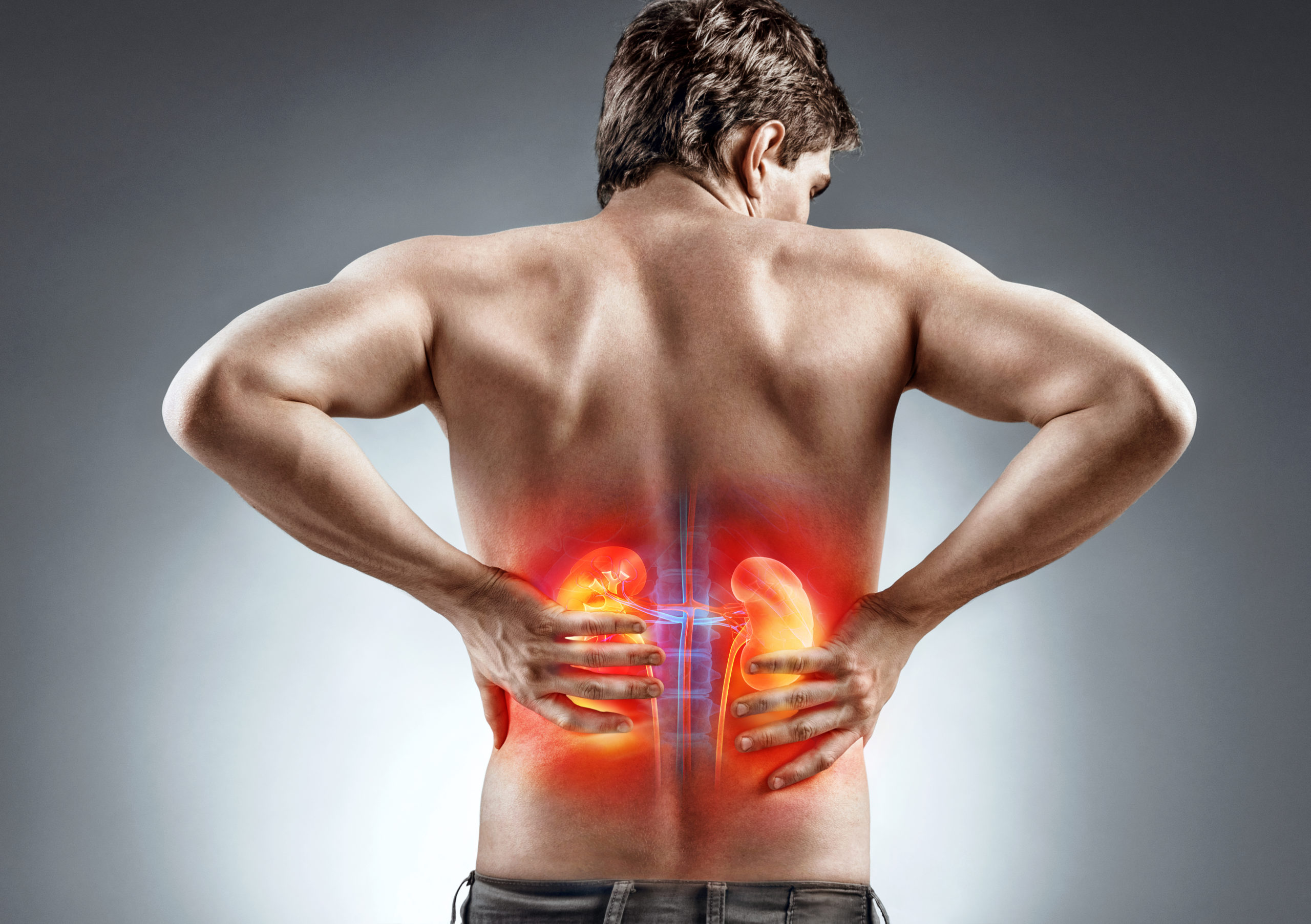 Kidney Pain – Causes, Symptoms, and Treatments