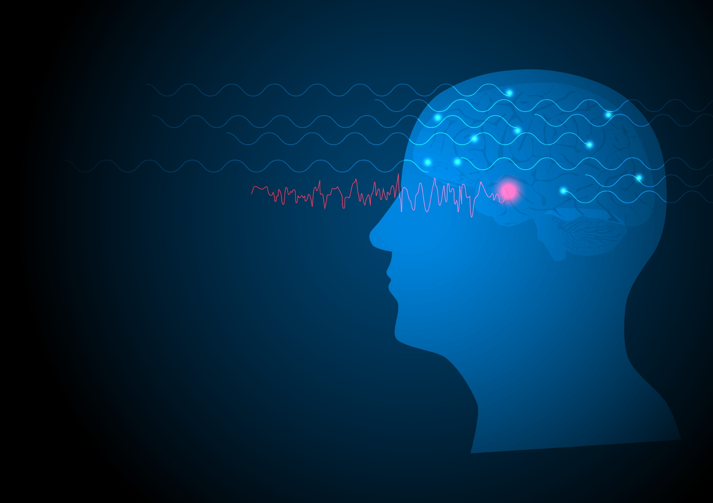 Temporal Lobe Seizure