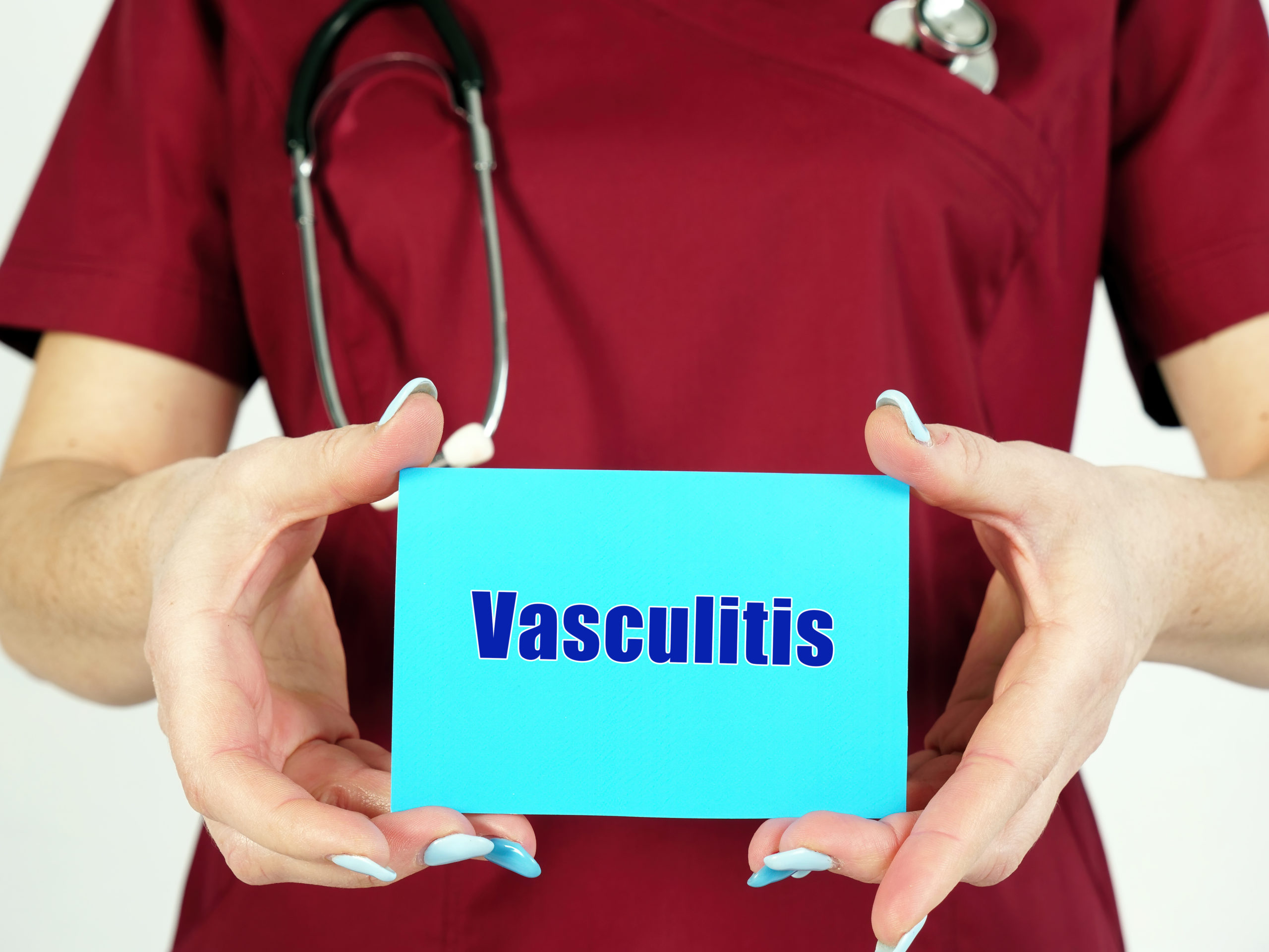 Vasculitis